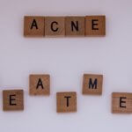 Best Acne Treatment for Men